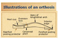 Illustrations of orthosis